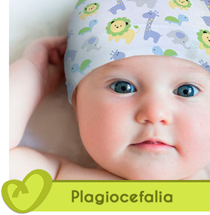tratamiento-plagiocefalia-fuengirola.png